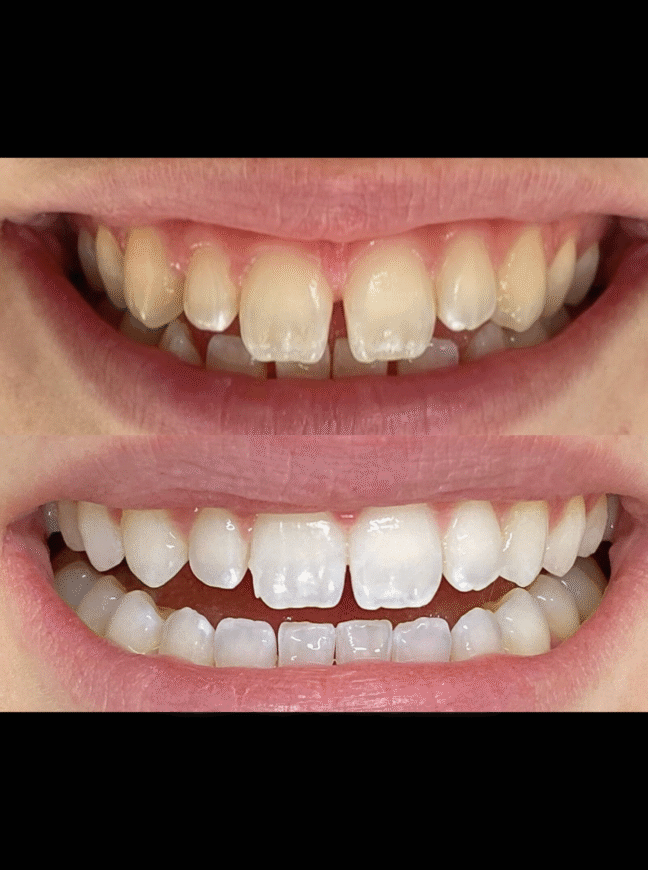 Treatment - Lighthouse Dental