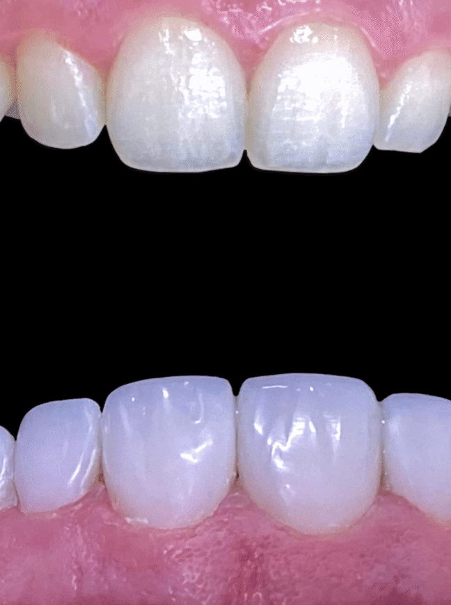 Treatment - Lighthouse Dental