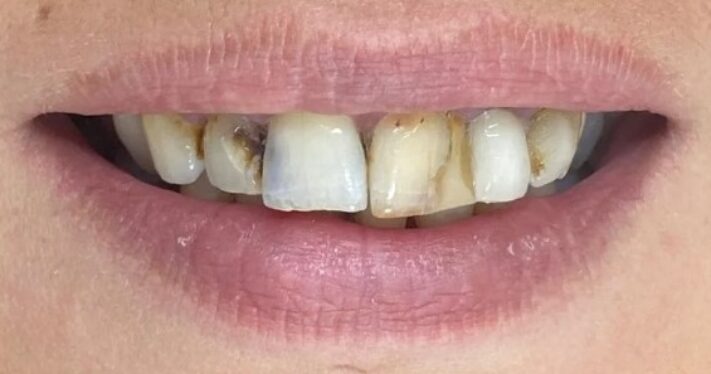 Before - Lighthouse Dental