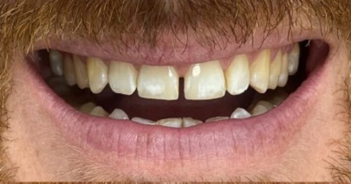Before - Lighthouse Dental