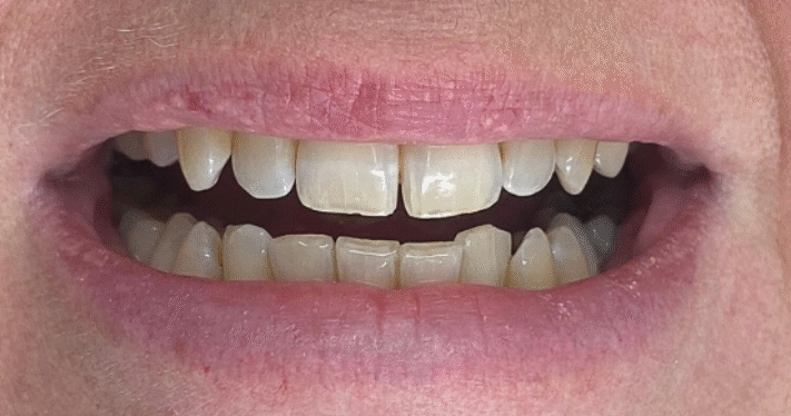 Before - Lighthouse Dental