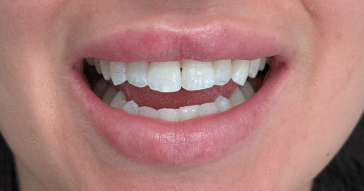 Before - Lighthouse Dental