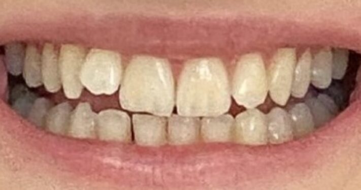 Before - Lighthouse Dental