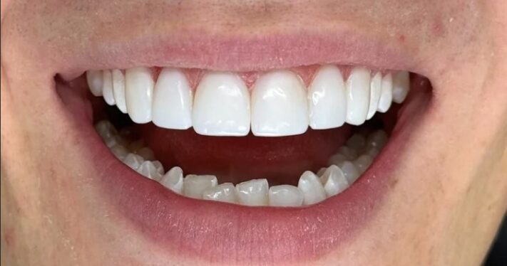 After - Lighthouse Dental