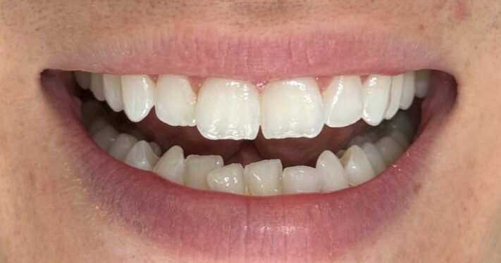 Before - Lighthouse Dental