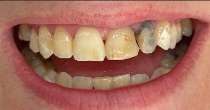 Before - Lighthouse Dental
