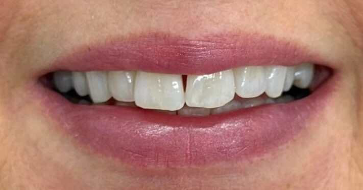 Before - Lighthouse Dental