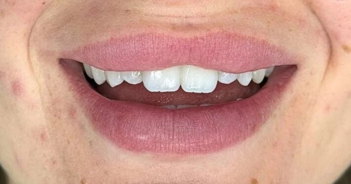 Before - Lighthouse Dental