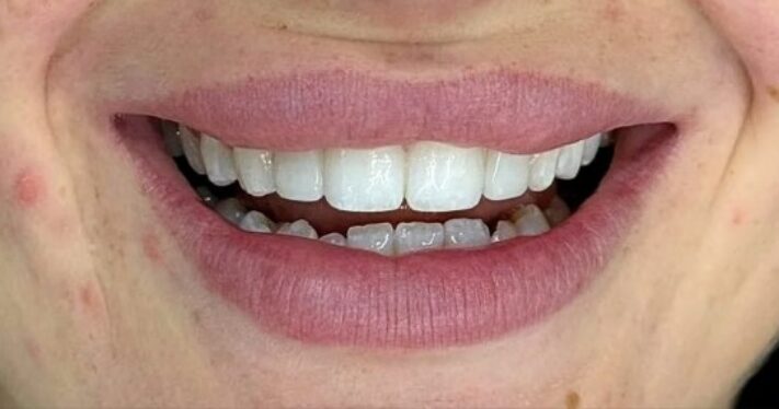 After - Lighthouse Dental