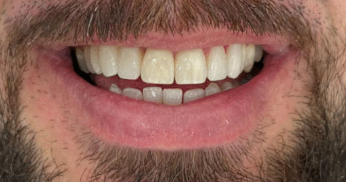 After - Lighthouse Dental