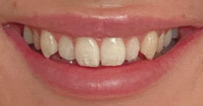 Before - Lighthouse Dental