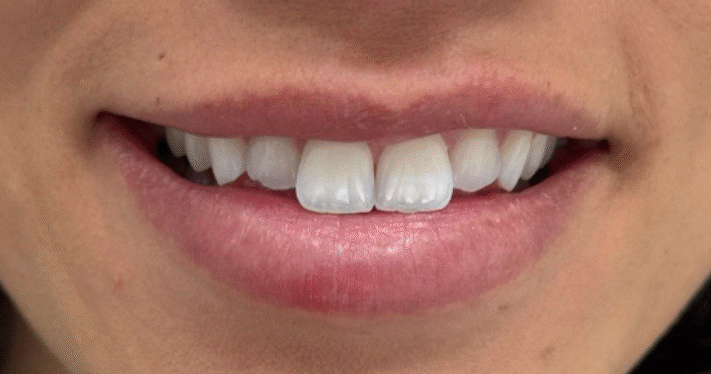 Before - Lighthouse Dental