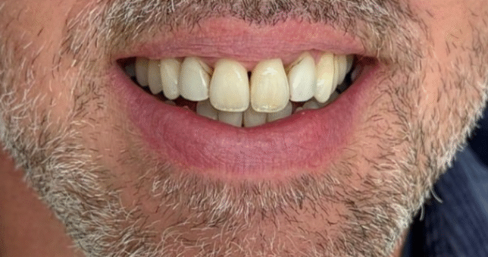 Before - Lighthouse Dental