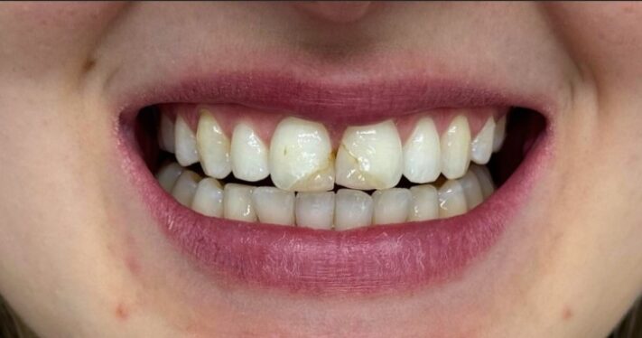 Before - Lighthouse Dental