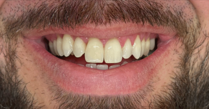Before - Lighthouse Dental