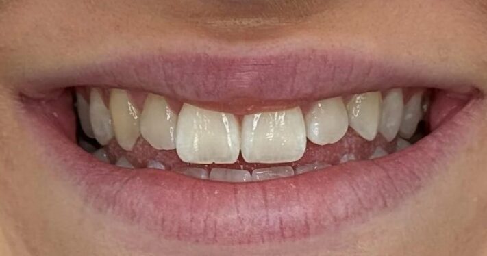 Before - Lighthouse Dental